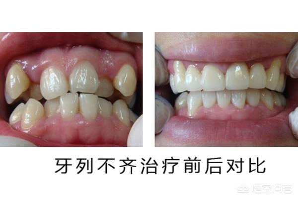 重庆最新24小时牙医在线咨询方法分析(最方便真实的重庆有没有24小时牙医方法)